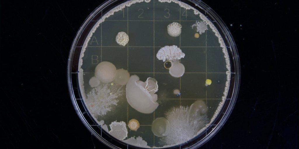 Petri dish with bacteria