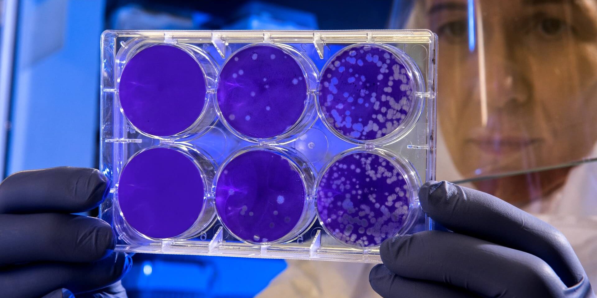 Scientist examines the result of a plaque assay, which is a test that allows scientists to count how many flu virus particles (virions) are in a mixture.