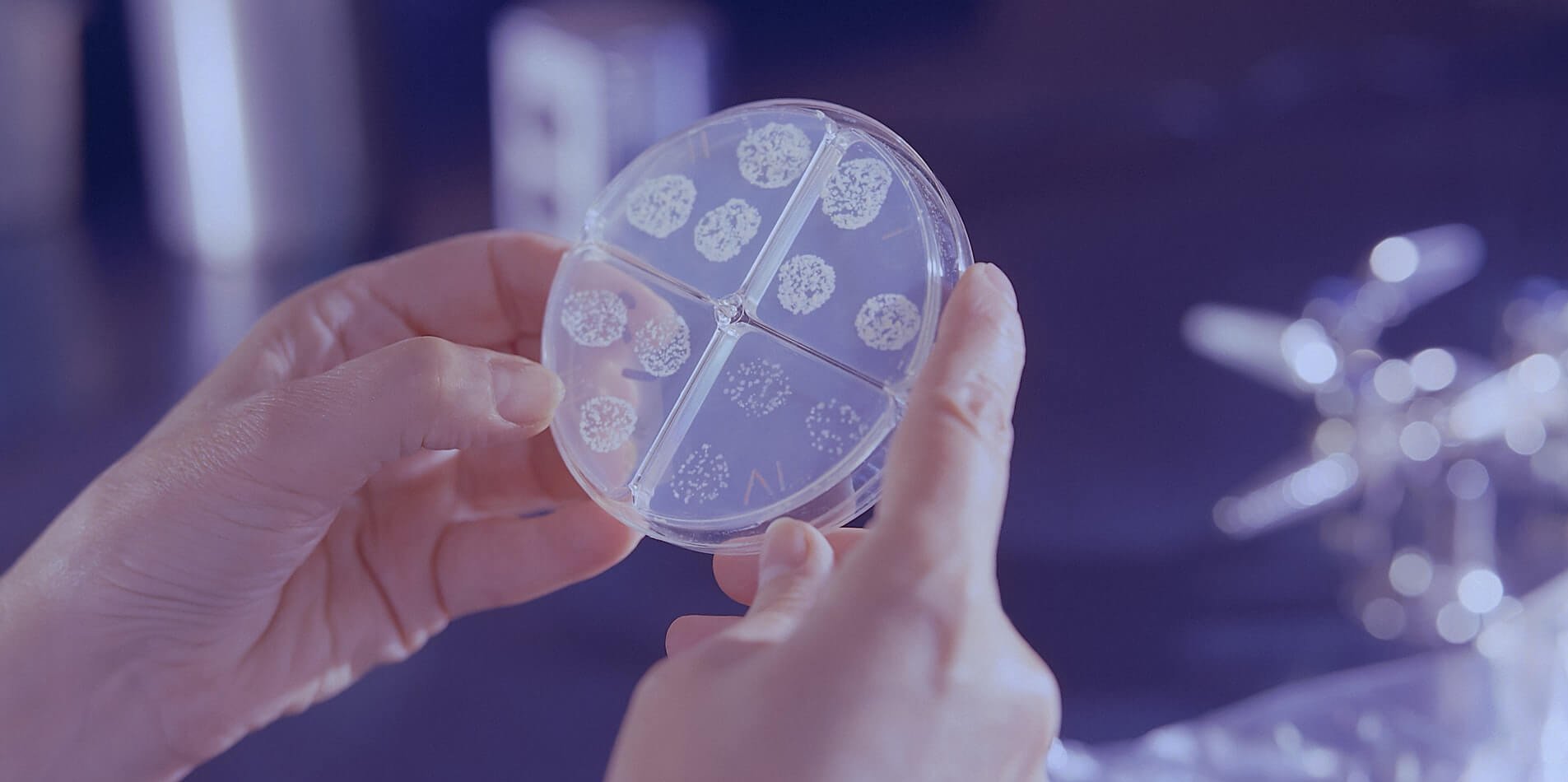 Mycobacterium tuberculosis drug susceptibility test on petri dish