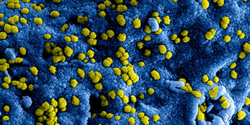 See suurelt suurendatud, digitaalselt värvitud skaneeriv elektronmikroskoopiline pilt näitab ultrastruktuurseid üksikasju paljude kollase värvusega respiratoorse sündroomiga koroonaviiruse viiruseosakeste interaktsiooni kohas, mis paiknevad Vero E6 raku pinnal, mis oli värvitud siniseks.