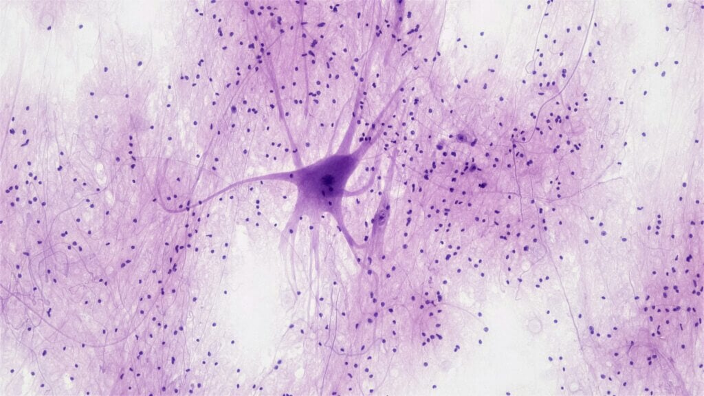 Tisyu sa Nerbiyos: Spinal Cord Motor Neuron. smear: pagpadako sa spinal cord: 100x